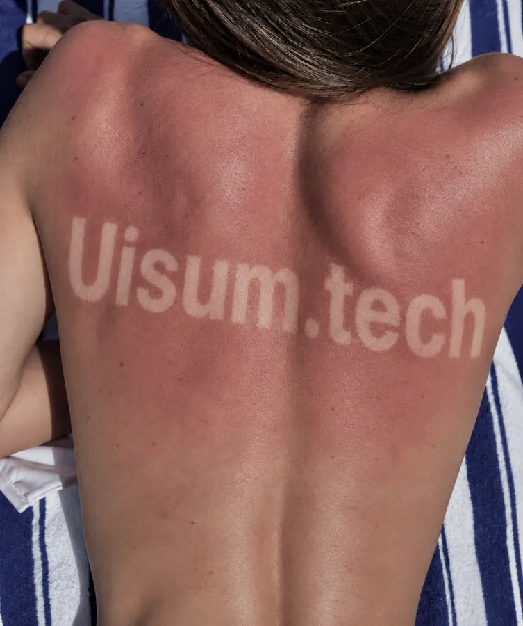 Rücken mit dem Schriftzug Uisum.tech als Sonnenbräune